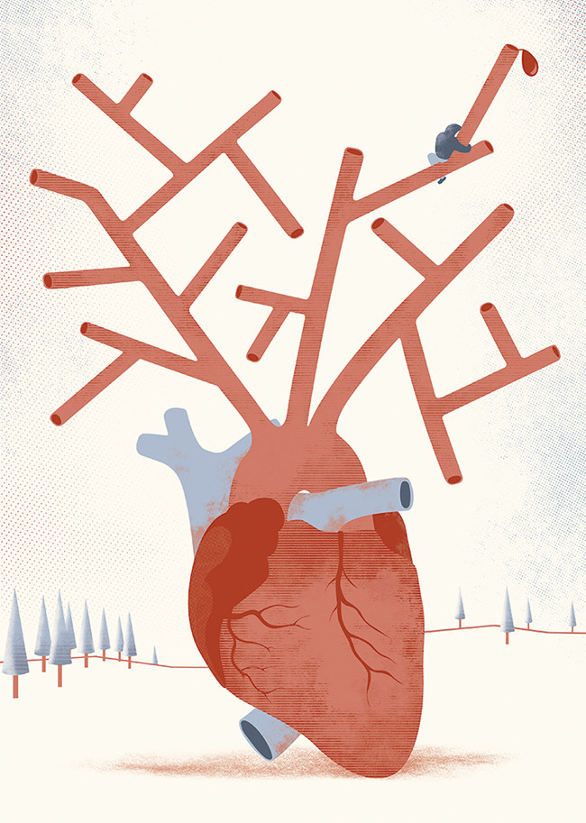 ARcardiogramas-aguante