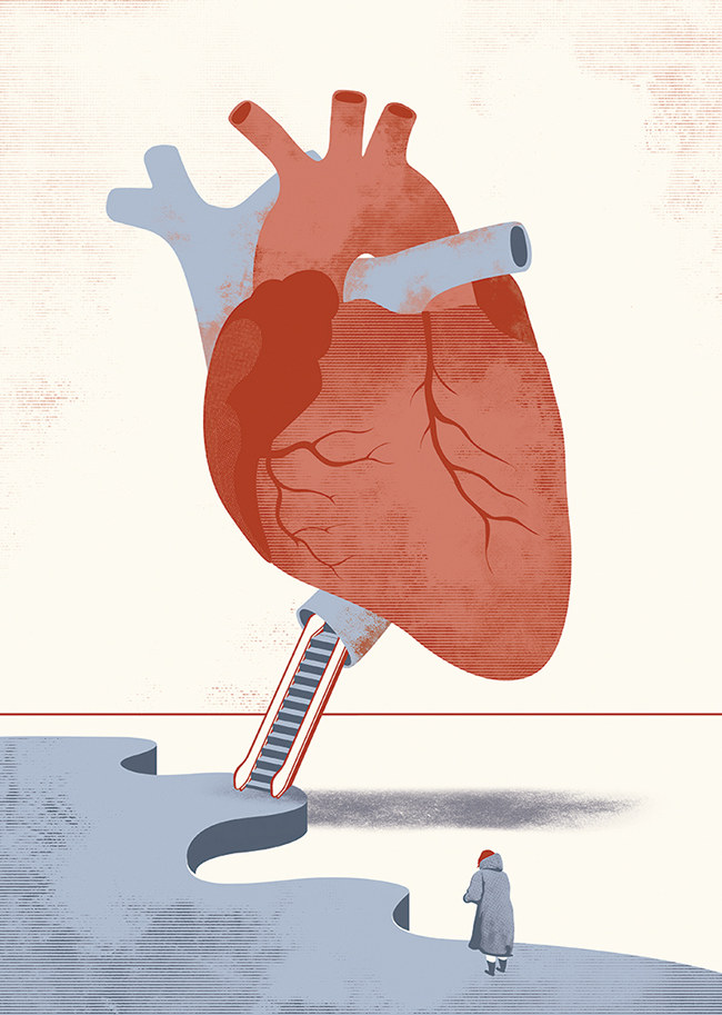 ARcardiogramas-decision