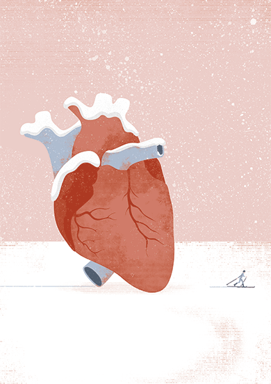 cardiogramas2